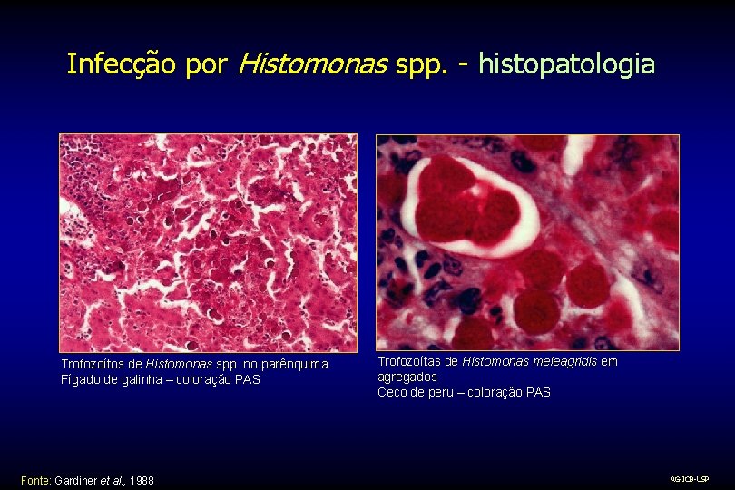 Infecção por Histomonas spp. - histopatologia Trofozoítos de Histomonas spp. no parênquima Fígado de