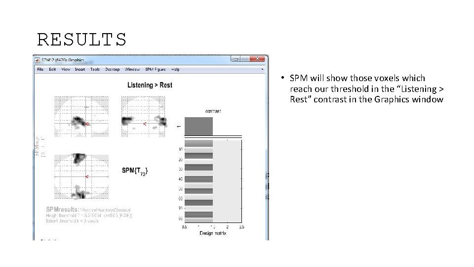 RESULTS • SPM will show those voxels which reach our threshold in the “Listening