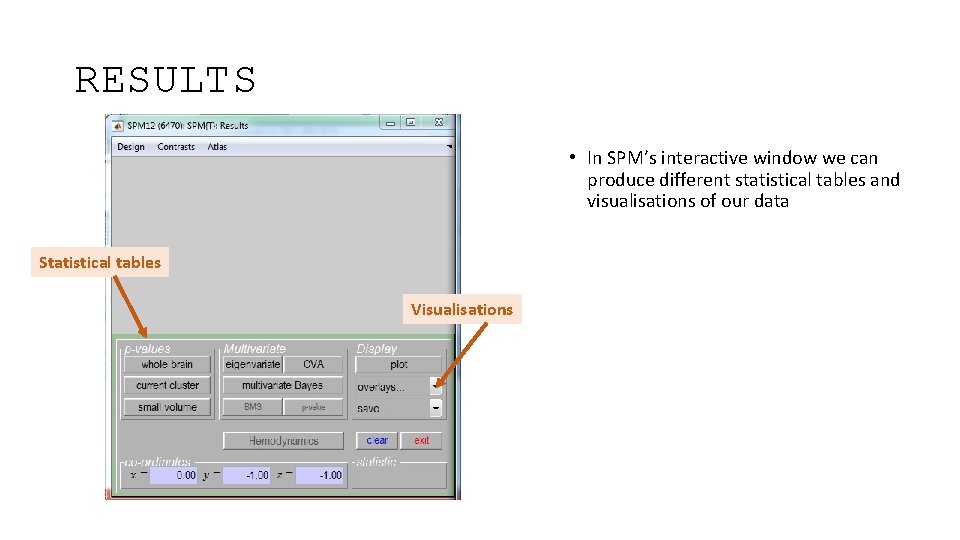 RESULTS • In SPM’s interactive window we can produce different statistical tables and visualisations