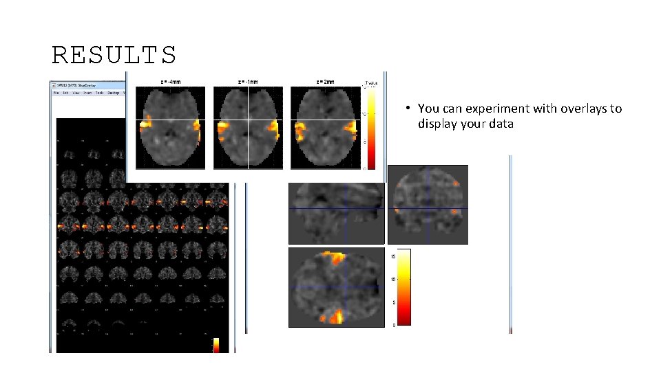 RESULTS • You can experiment with overlays to display your data 