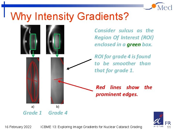 Why Intensity Gradients? Consider sulcus as the Region Of Interest (ROI) enclosed in a