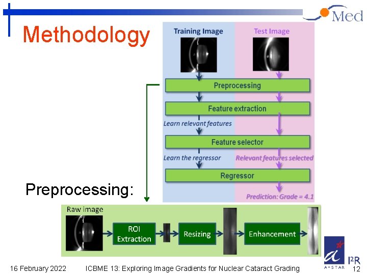 Methodology Preprocessing: 16 February 2022 ICBME 13: Exploring Image Gradients for Nuclear Cataract Grading