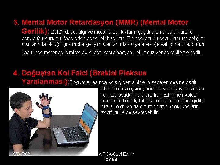 3. Mental Motor Retardasyon (MMR) (Mental Motor Gerilik): Zekâ, duyu, algı ve motor bozuklukların