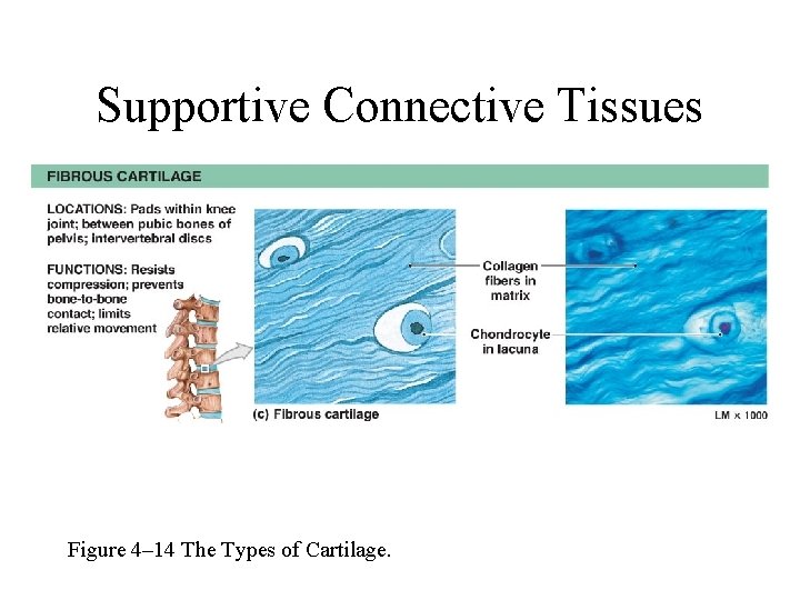 Supportive Connective Tissues Figure 4– 14 The Types of Cartilage. 