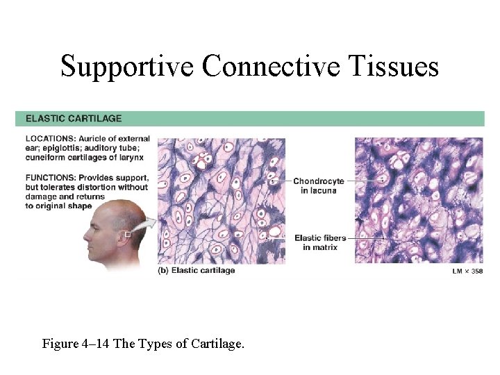Supportive Connective Tissues Figure 4– 14 The Types of Cartilage. 
