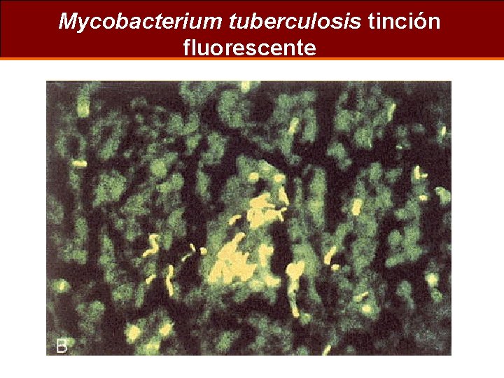 Mycobacterium tuberculosis tinción fluorescente 