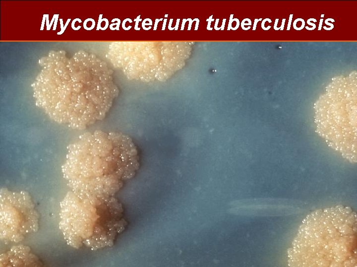 Mycobacterium tuberculosis . Departamento de Microbiología 