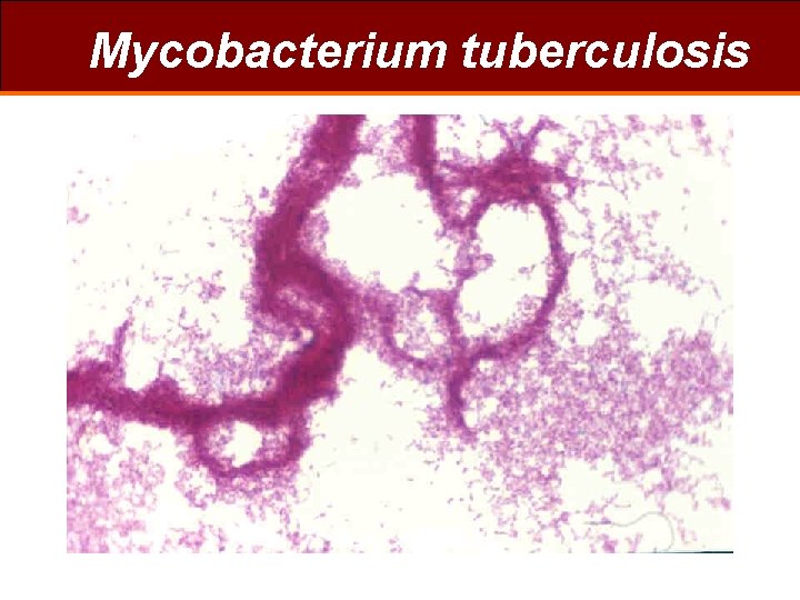 Mycobacterium tuberculosis 