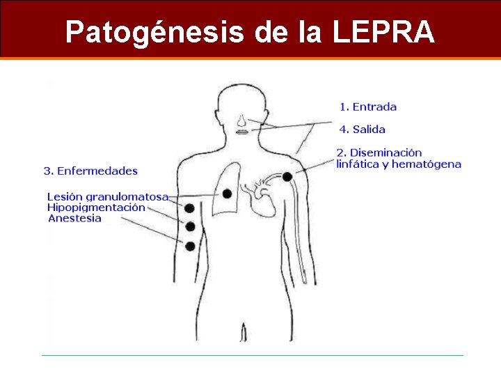 Patogénesis de la LEPRA 