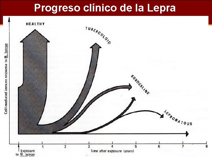 Progreso clínico de la Lepra 