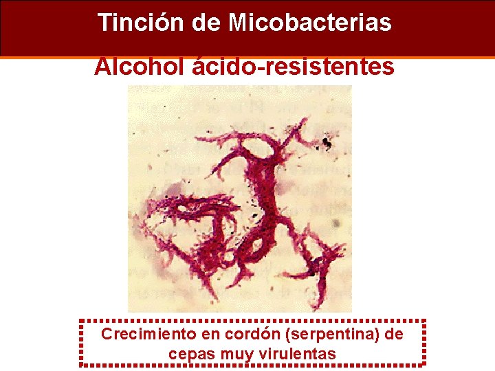 Tinción de Micobacterias Alcohol ácido-resistentes Crecimiento en cordón (serpentina) de cepas muy virulentas 