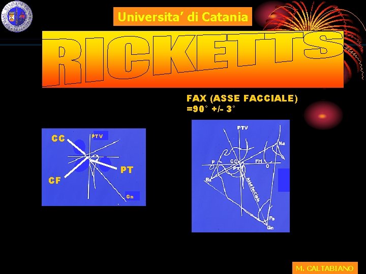 Universita’ di Catania FAX (ASSE FACCIALE) =90° +/- 3° CC CF PTV PT Gn