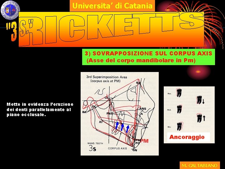 Universita’ di Catania 3) SOVRAPPOSIZIONE SUL CORPUS AXIS (Asse del corpo mandibolare in Pm)