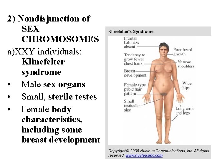 2) Nondisjunction of SEX CHROMOSOMES a)XXY individuals: Klinefelter syndrome • Male sex organs •