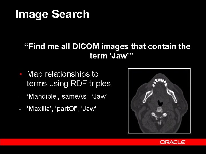 Image Search “Find me all DICOM images that contain the term ‘Jaw’” • Map
