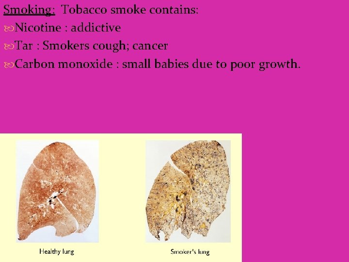 Smoking: Tobacco smoke contains: Nicotine : addictive Tar : Smokers cough; cancer Carbon monoxide