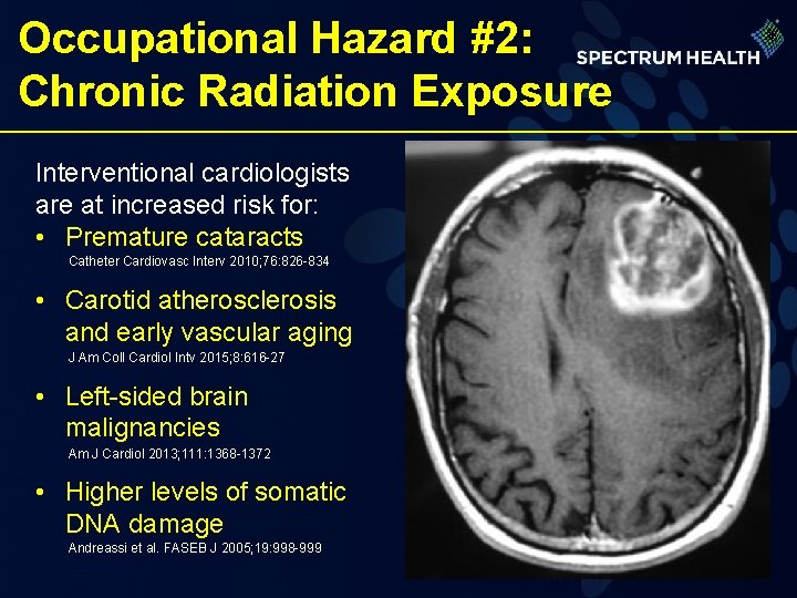 Occupational Hazard #2: Chronic Radiation Exposure Interventional cardiologists are at increased risk for: •