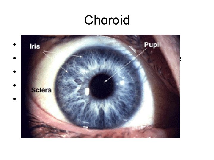 Choroid • • • Darkly coloured Front part – iris – coloured part of
