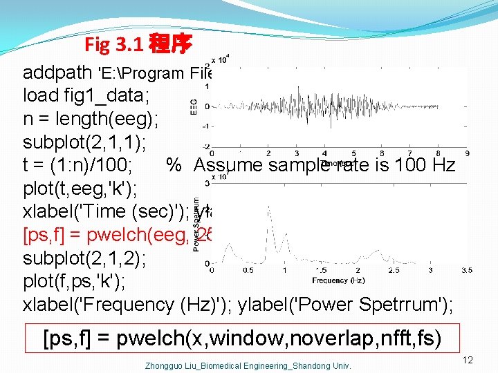 Fig 3. 1 程序 addpath 'E: Program FilesMATLABbiosignalcdChapter 3' load fig 1_data; n =
