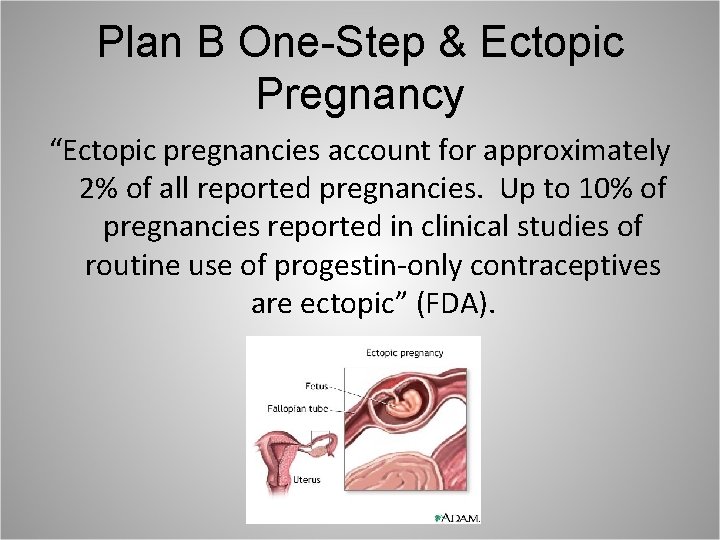 Plan B One-Step & Ectopic Pregnancy “Ectopic pregnancies account for approximately 2% of all