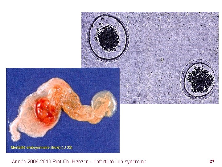 Année 2009 -2010 Prof Ch. Hanzen - l’infertilité : un syndrome 27 