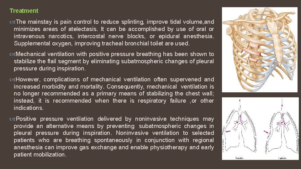 Treatment The mainstay is pain control to reduce splinting, improve tidal volume, and minimizes