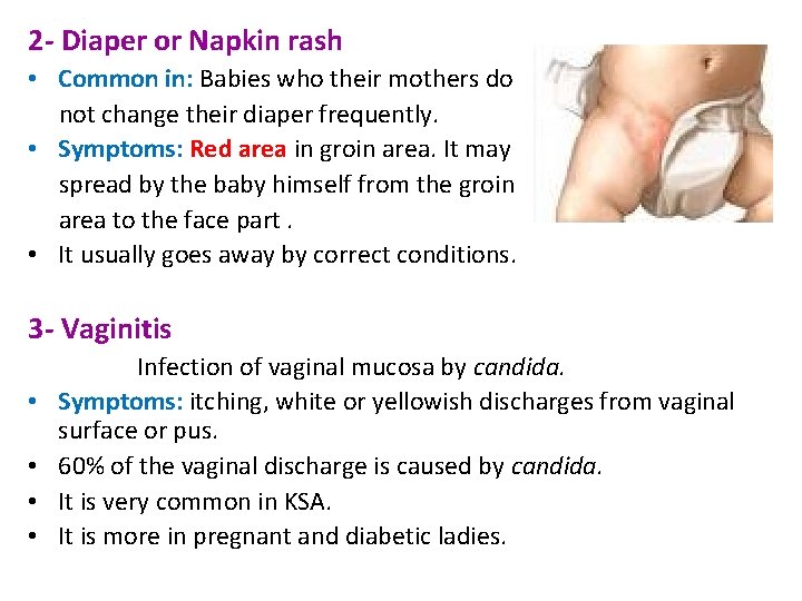 2 - Diaper or Napkin rash • Common in: Babies who their mothers do