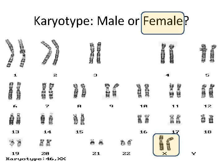 Karyotype: Male or Female? 