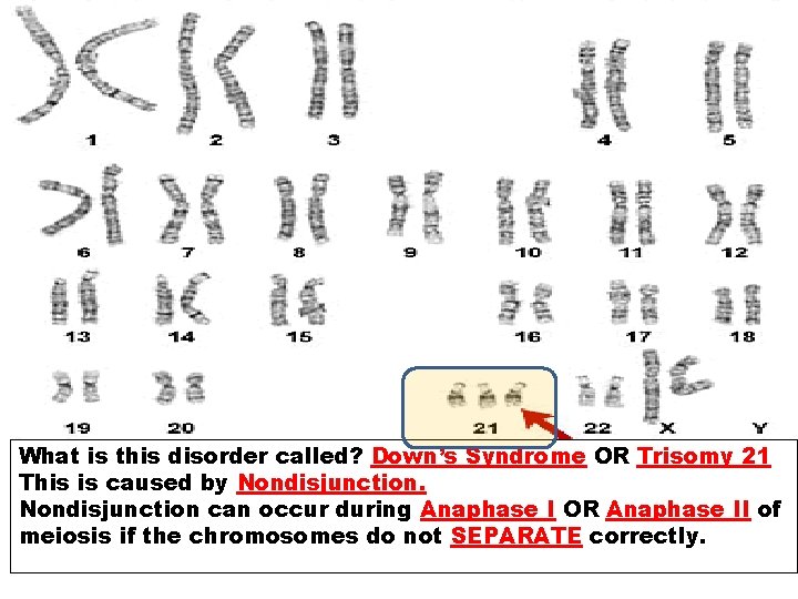 What is this disorder called? Down’s Syndrome OR Trisomy 21 This is caused by