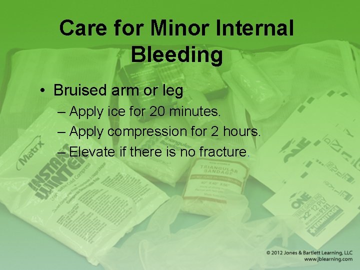 Care for Minor Internal Bleeding • Bruised arm or leg – Apply ice for