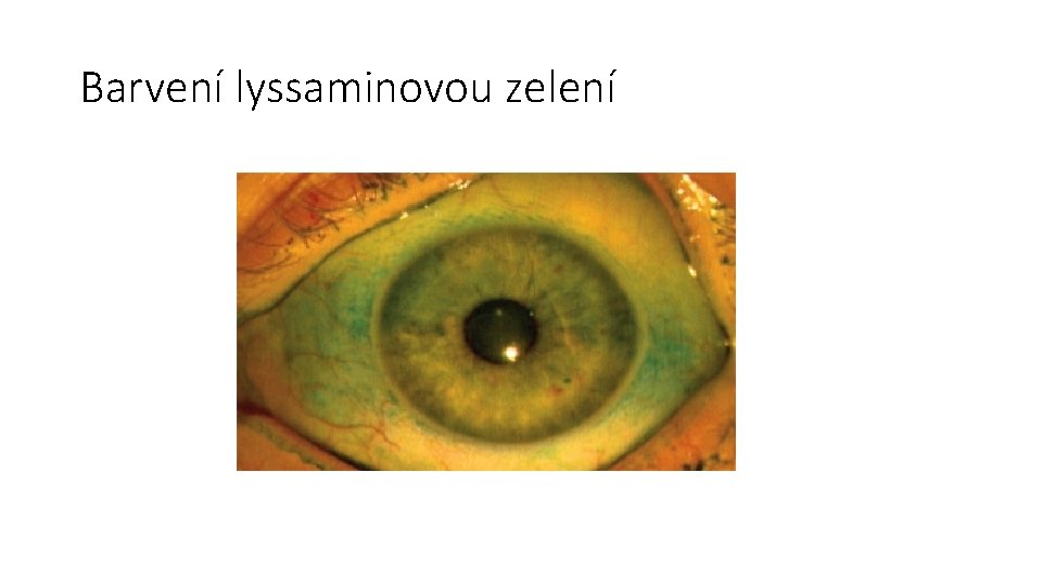 Barvení lyssaminovou zelení 