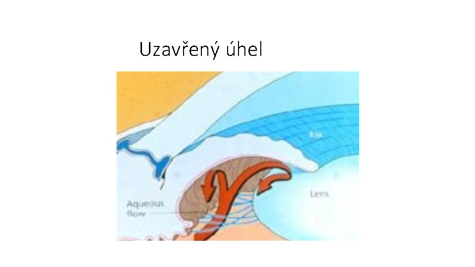 Uzavřený úhel 