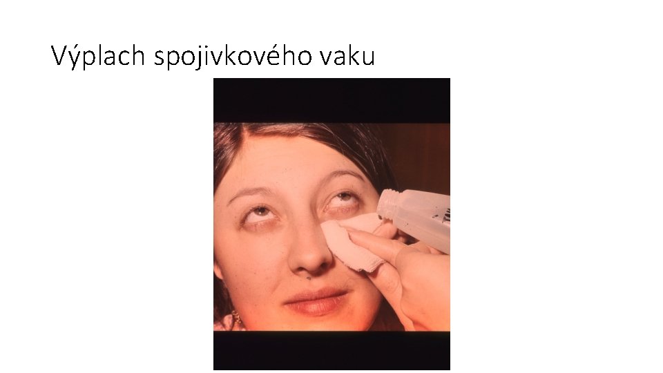 Výplach spojivkového vaku 