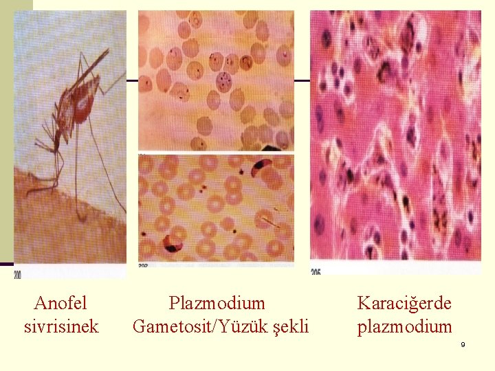 Anofel sivrisinek Plazmodium Gametosit/Yüzük şekli Karaciğerde plazmodium 9 