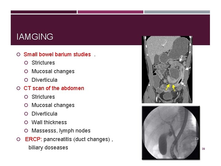 IAMGING Small bowel barium studies. Strictures Mucosal changes Diverticula CT scan of the abdomen