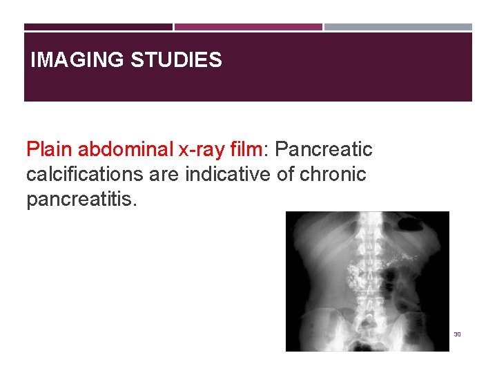 IMAGING STUDIES Plain abdominal x-ray film: Pancreatic calcifications are indicative of chronic pancreatitis. 30