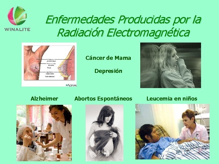 Enfermedades Producidas por la Radiación Electromagnética Cáncer de Mama Depresión Alzheimer Abortos Espontáneos Leucemia