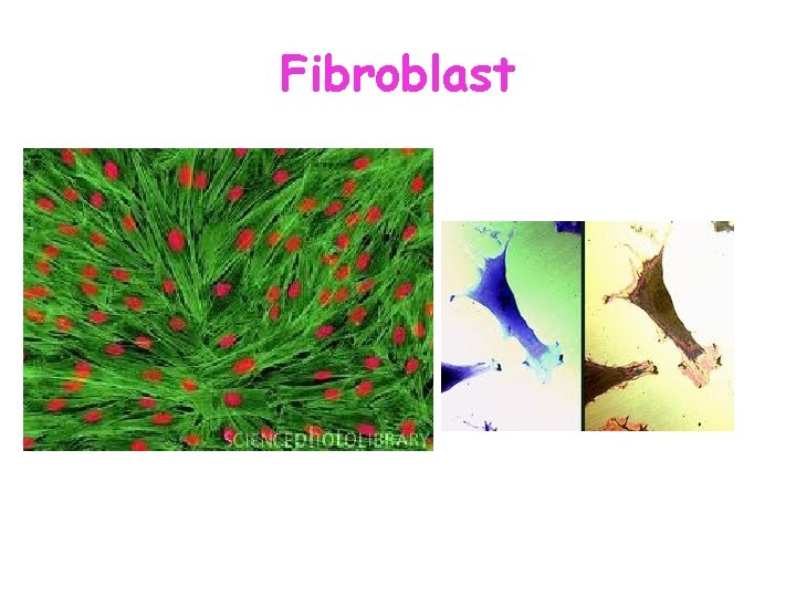 Fibroblast  Fibroblast
