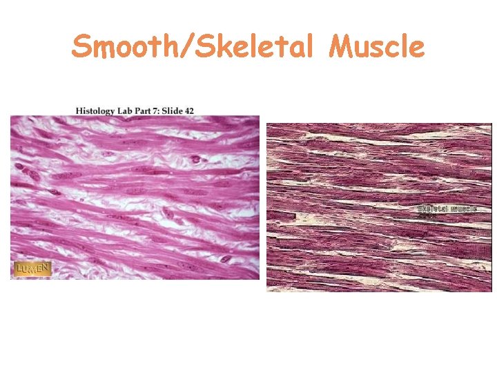 Smooth/Skeletal Muscle  Smooth/Skeletal Muscle