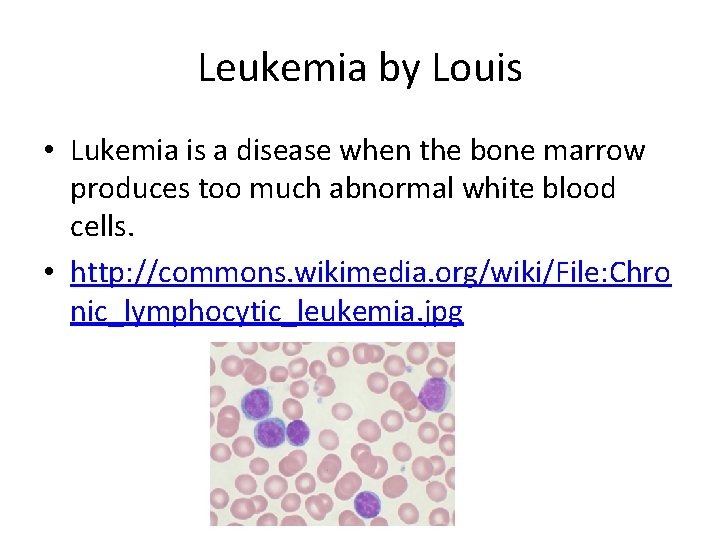 Leukemia by Louis • Lukemia is a disease when the bone marrow produces too