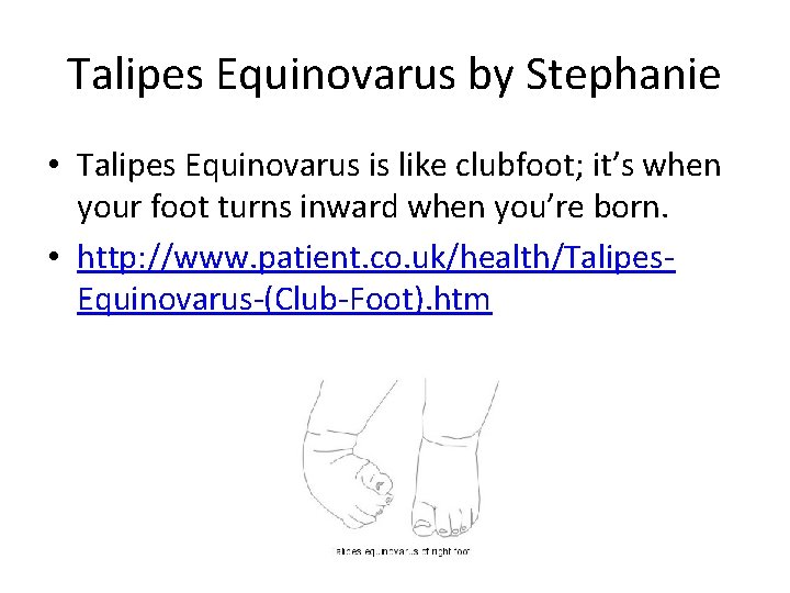 Talipes Equinovarus by Stephanie • Talipes Equinovarus is like clubfoot; it’s when your foot