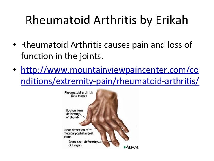 Rheumatoid Arthritis by Erikah • Rheumatoid Arthritis causes pain and loss of function in