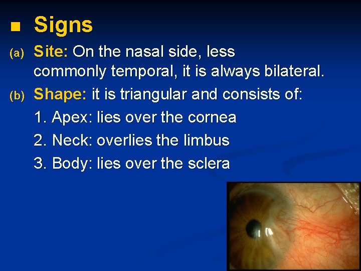 n (a) (b) Signs Site: On the nasal side, less commonly temporal, it is
