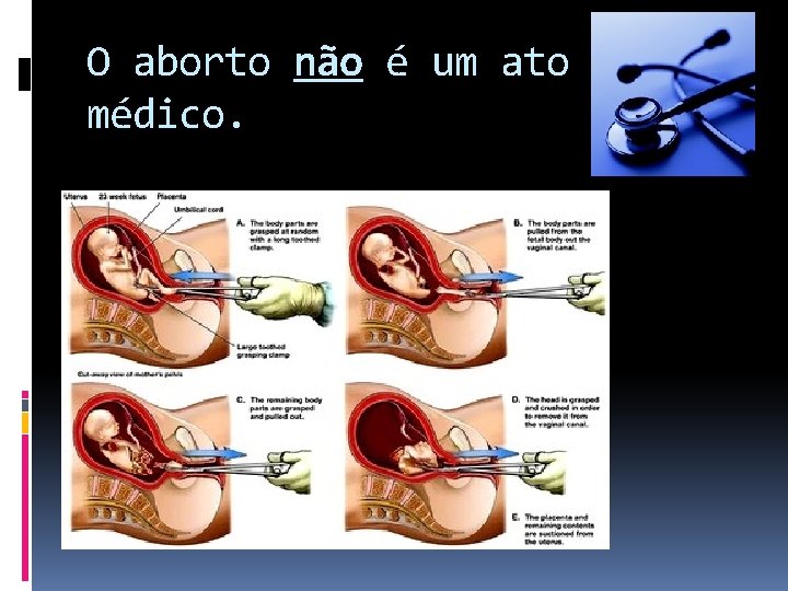 O aborto não é um ato médico. 