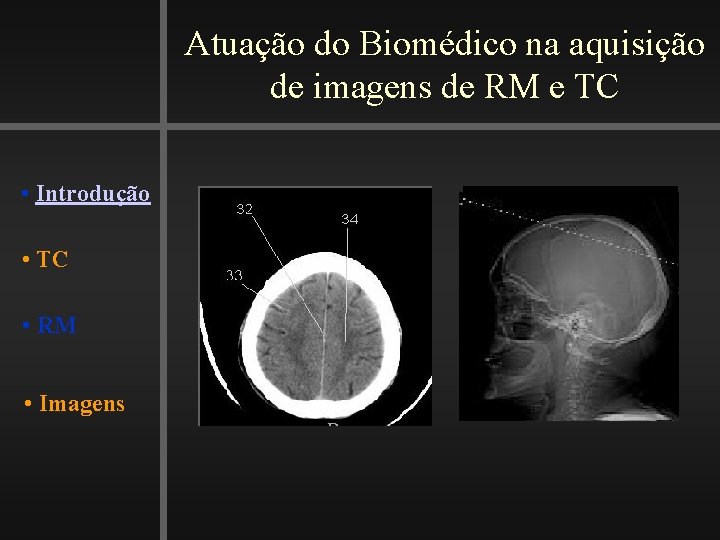 Atuação do Biomédico na aquisição de imagens de RM e TC • Introdução •