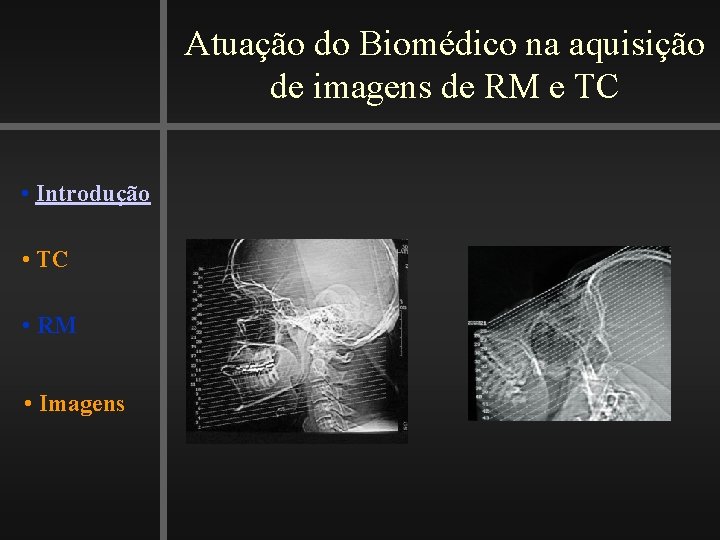 Atuação do Biomédico na aquisição de imagens de RM e TC • Introdução •