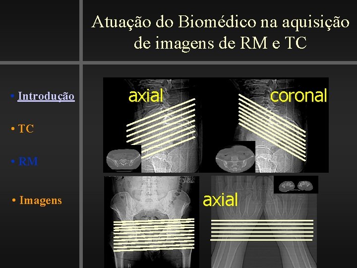 Atuação do Biomédico na aquisição de imagens de RM e TC • Introdução axial