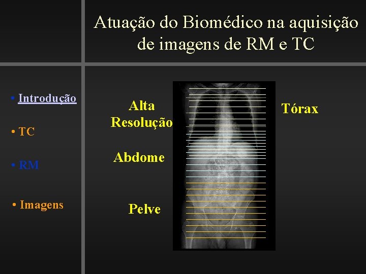 Atuação do Biomédico na aquisição de imagens de RM e TC • Introdução •