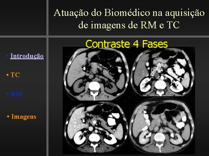 Atuação do Biomédico na aquisição de imagens de RM e TC Contraste 4 Fases