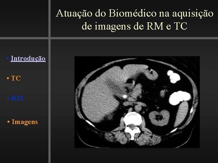 Atuação do Biomédico na aquisição de imagens de RM e TC • Introdução •